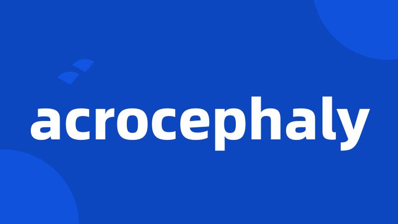 acrocephaly