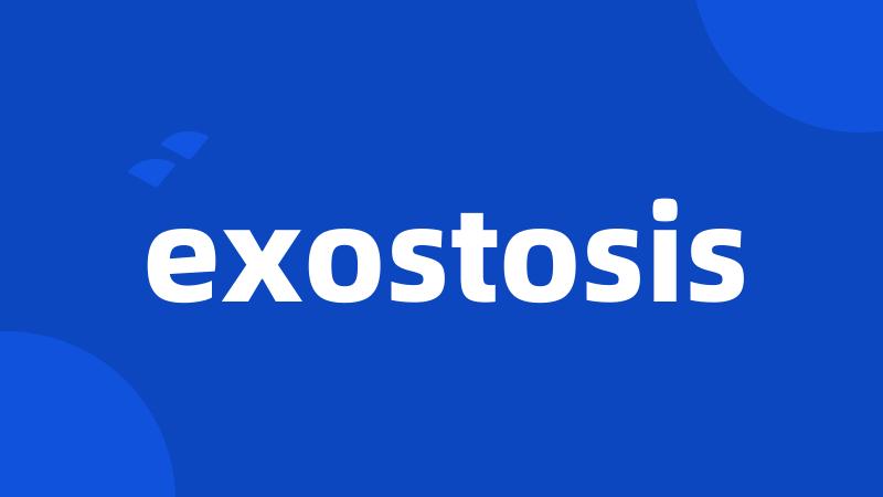 exostosis